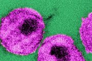HIV prevention drug roll-out delayed over coronavirus