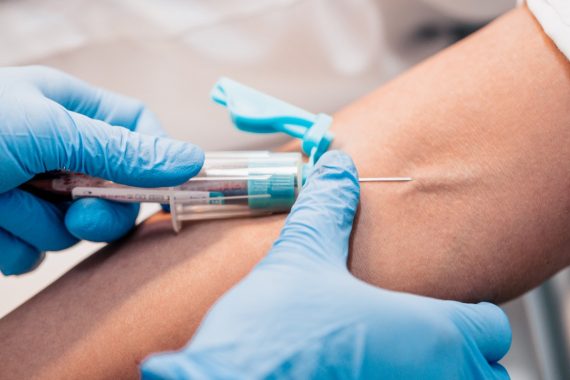 GPs fear financial losses and patient abuse due to blood test shortage
