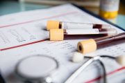 GPs must still ration blood tests despite emergency tube order, says NHS England