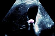 Clinical clangers: ‘It must be the gallstones causing my abdominal pain’