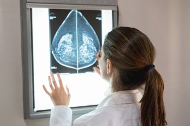 Women with dense breasts ‘should have additional cancer screening tests’