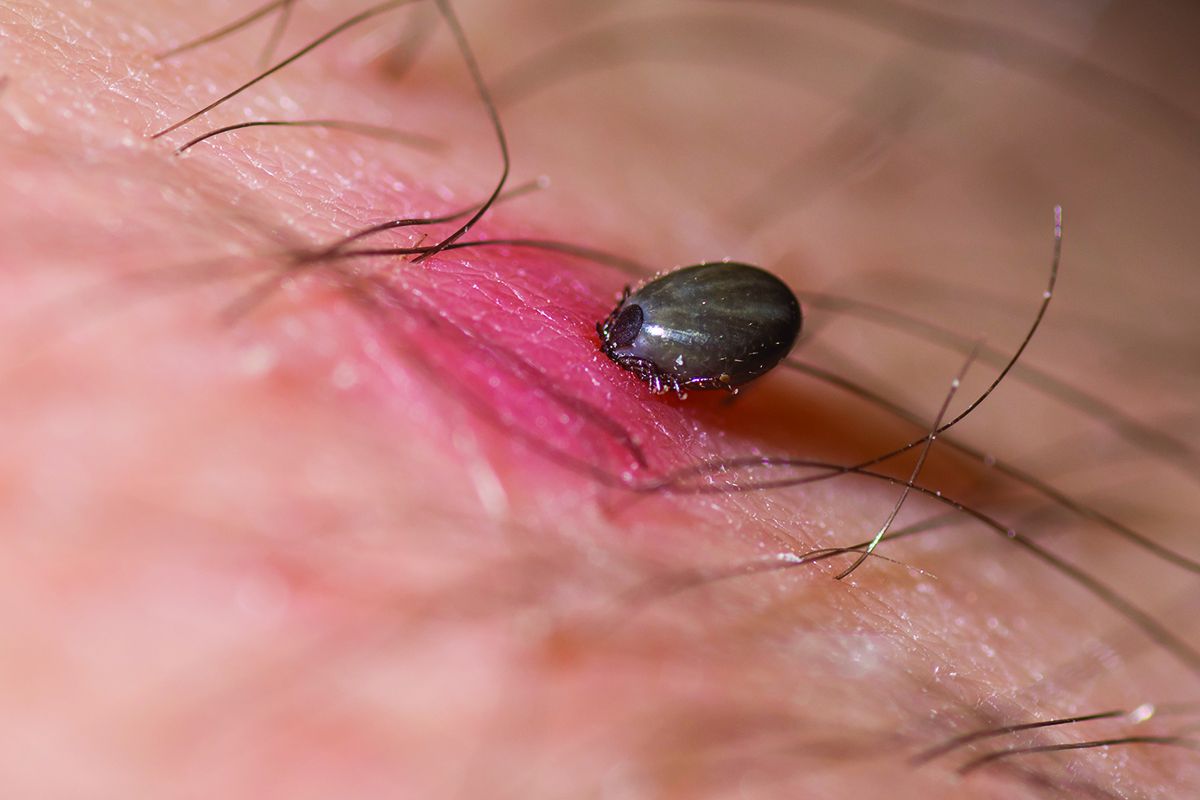 Patients with tick bites advised to see GP if unwell after TBE detected in UK
