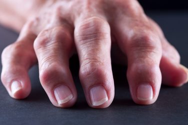 Painkiller use in inflammatory arthritis is ‘widespread’ despite no benefit