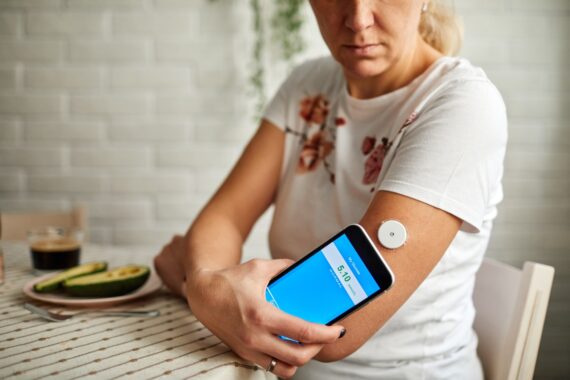 Continuous blood glucose monitoring tech to be expanded to all type 1 diabetes patients
