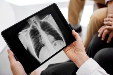 GPs to offer TB symptom screening to new Ukrainian patients