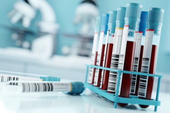 One in four blood tests in general practice may be unnecessary
