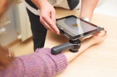 AI skin cancer triage given conditional green light by NICE