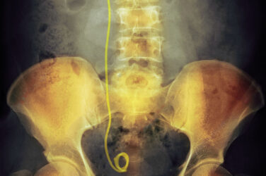Rational referrals: Urology