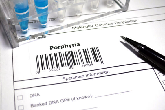 Once in a lifetime: Porphyria