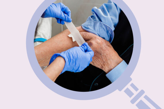 Case of the month: What is the abnormality in this elderly man’s blood tests?