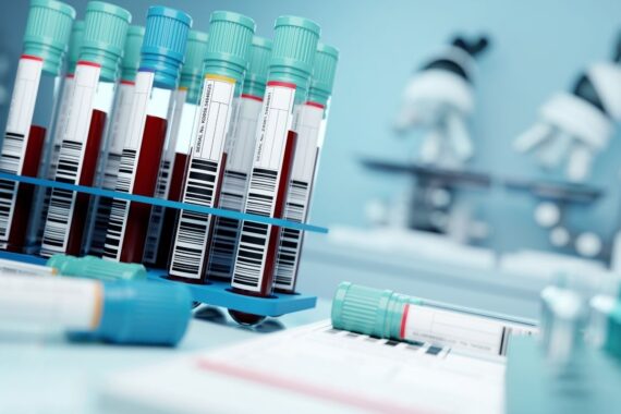 GPs ‘lose faith’ in blood testing provider amid ‘inaccurate’ results claims