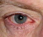 Key questions on eye and eyelid conditions (1 CPD hour)